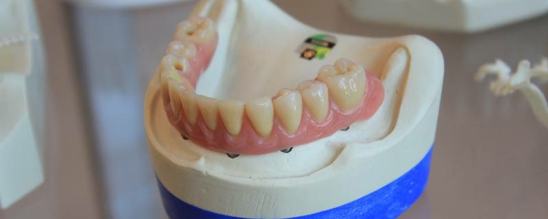 Dentalhygiene