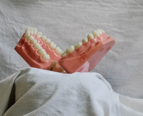 Implantatplanung
